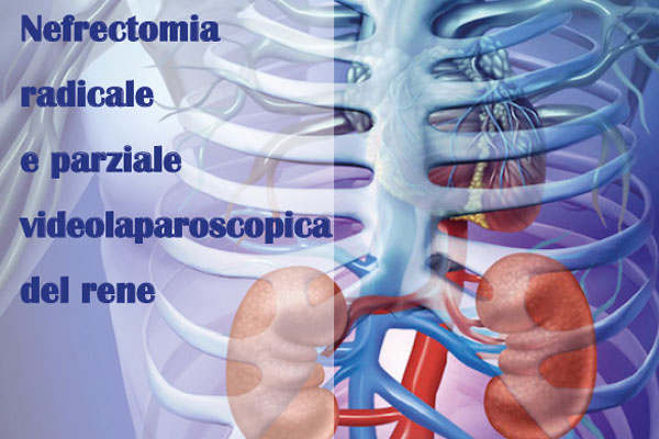 Nefrectomia radicale e parziale videolaparoscopica del rene – 24-25 Ottobre 2019